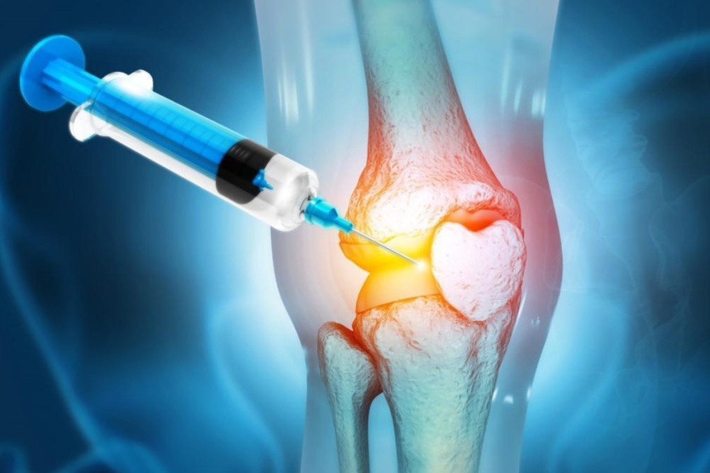 Cortisone, Prolotherapy, PRP or PRF. What’s the difference?